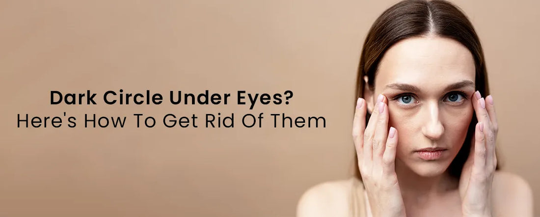 Dark Circle Under Eyes? Here's How To Get Rid Of Them