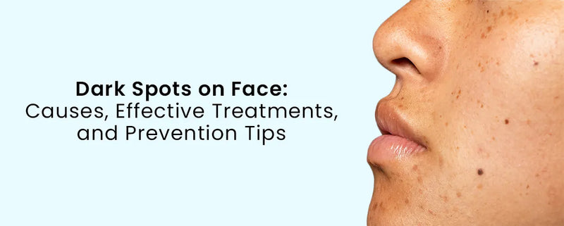 Dark Spots on Face: Causes, Effective Treatments, and Prevention Tips