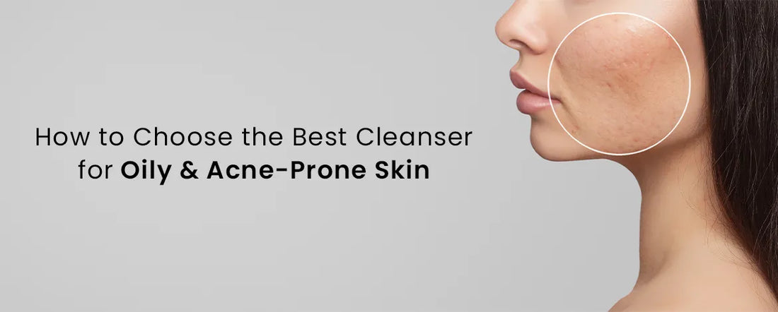 How to Choose the Best Cleanser for Oily & Acne Prone Skin