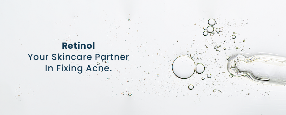 Retinol: Your Skincare Partner In Fixing Acne