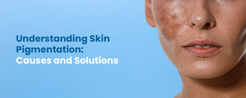 Understanding Skin Pigmentation: Causes and Solutions