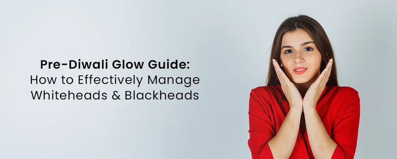 Pre-Diwali Glow Guide: How to Effectively Manage Whiteheads and Blackheads
