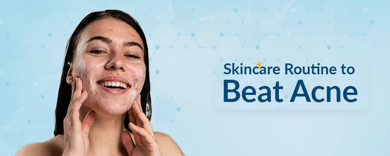 Skincare Routine to Beat Summer Acne