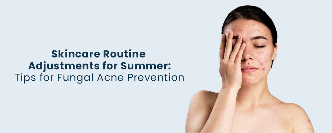 Skincare Routine Adjustments for Summer: Tips for Fungal Acne Prevention