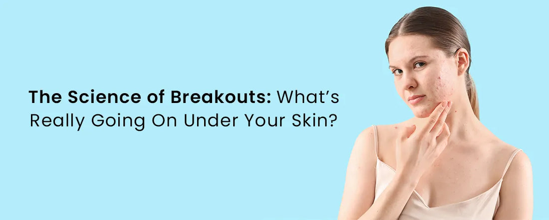 The Science of Breakouts Whats Really Going On Under Your Skin