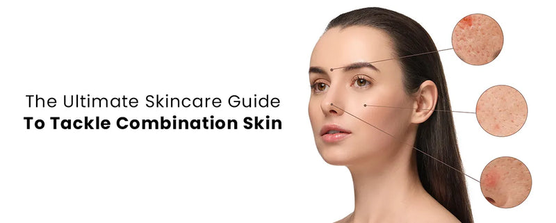 The Ultimate Skincare Guide To Tackle Combination Skin