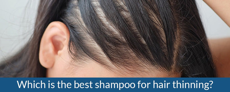 Which is the best shampoo for hair thinning?