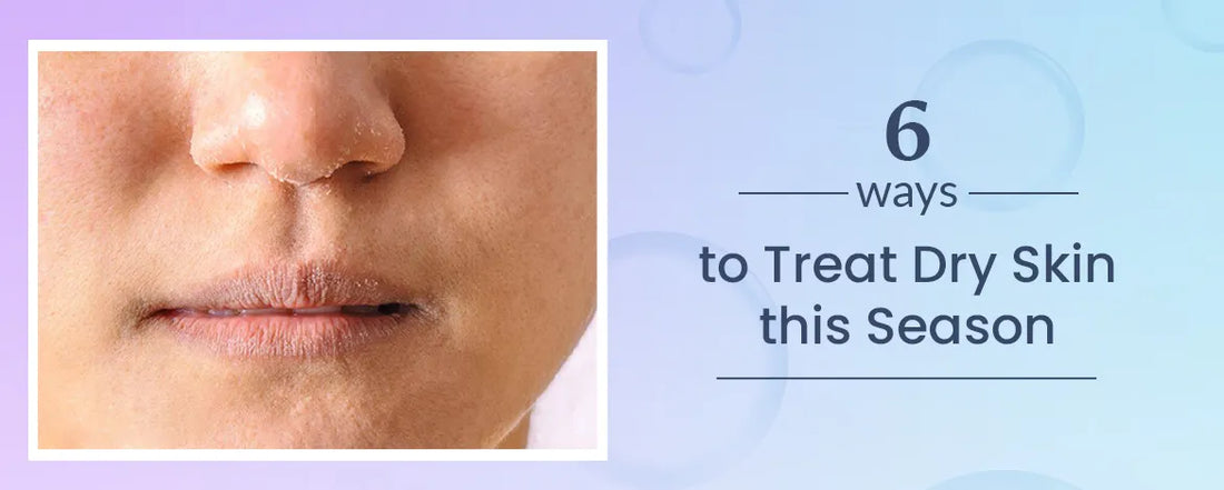 6 Ways to Treat Dry Skin this Season
