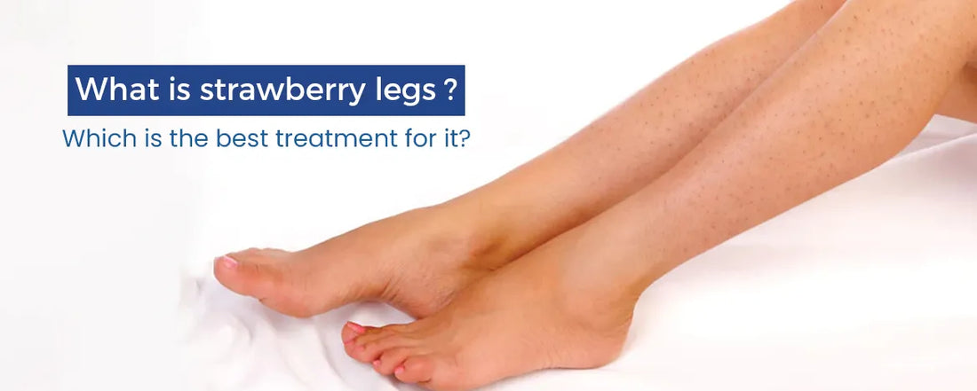 What is strawberry legs