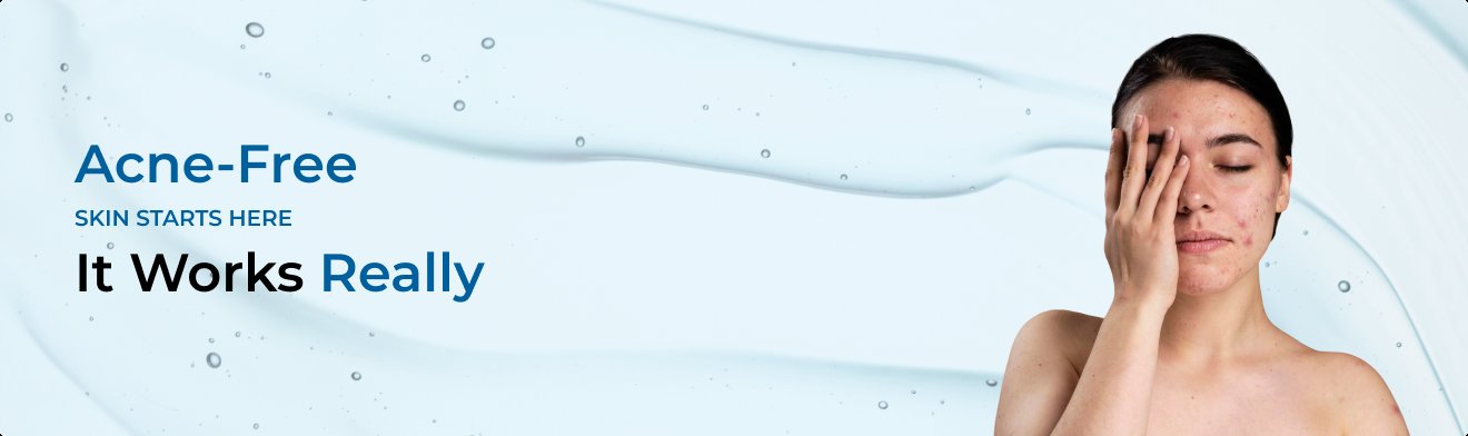 Acne Care Products For Oily And Acne prone skin