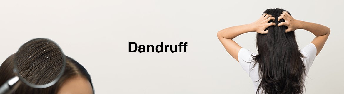 Dandruff