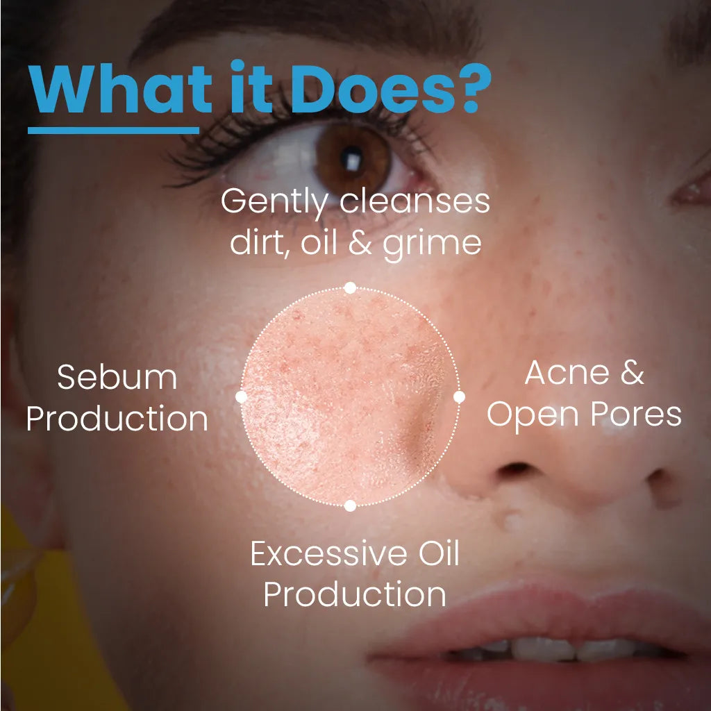Alpha Beta Acne Cleanser