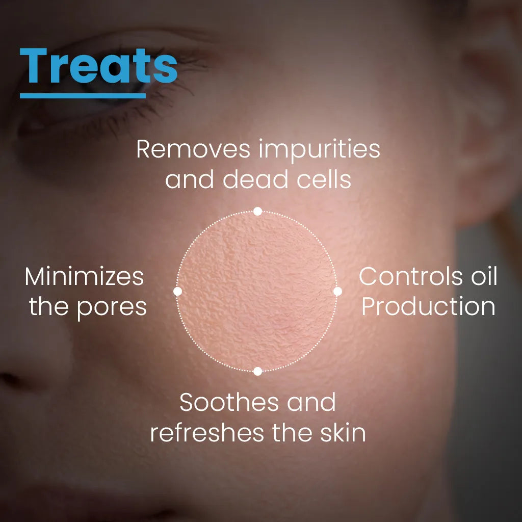 Face Toner for Oily & Acne-Prone Skin