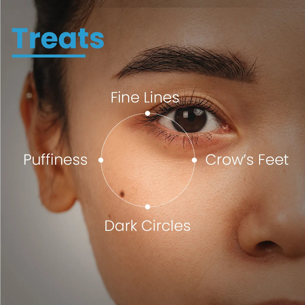 Eye Refining Matrix