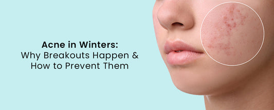 Acne in Winters: Why Breakouts Happen and How to Prevent Them