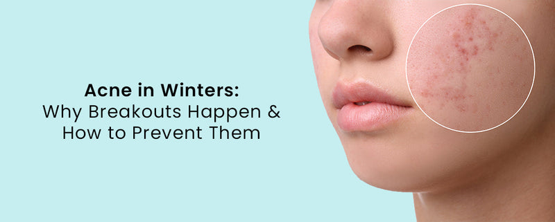 Acne in Winters: Why Breakouts Happen and How to Prevent Them