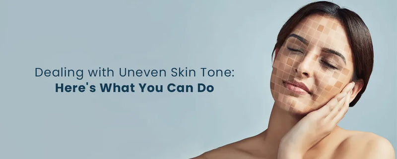 Dealing with Uneven Skin Tone: Here’s What You Can Do