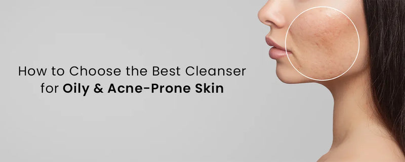How to Choose the Best Cleanser for Oily & Acne-Prone Skin?