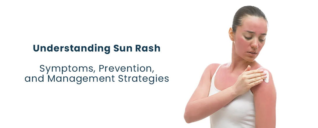 Understanding Sun Rash: Symptoms, Prevention, and Management Strategies