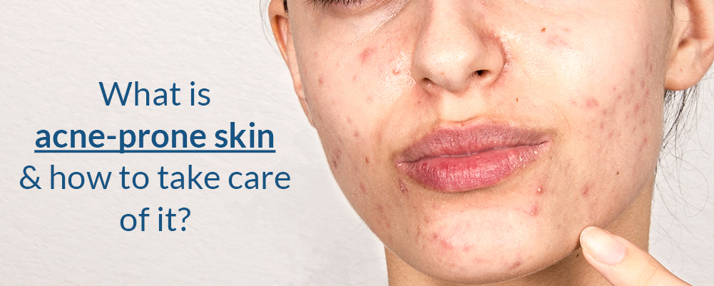 how to take care acne-prone skin