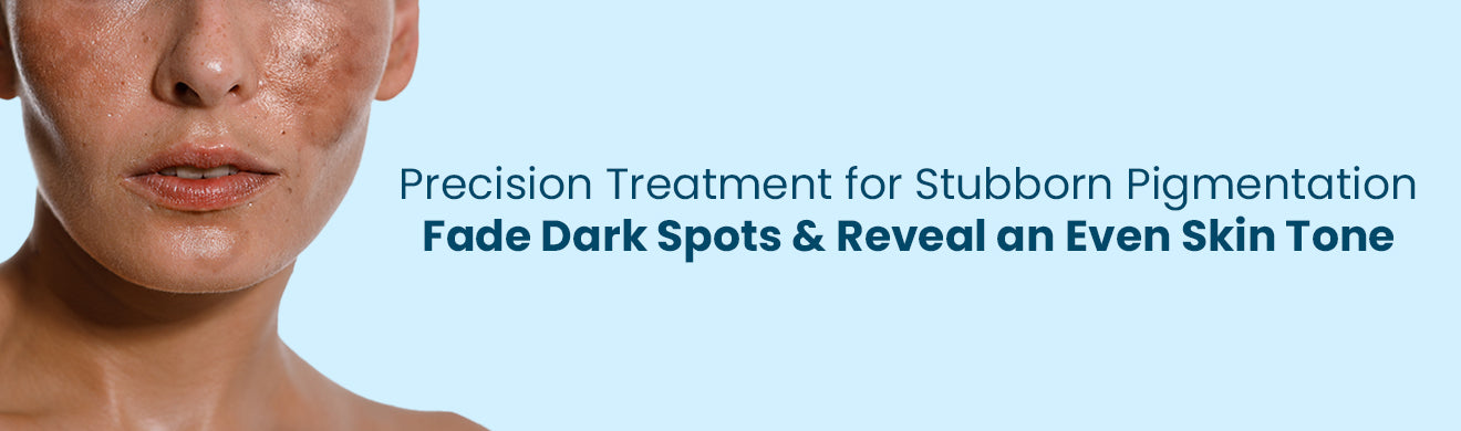 fight Hyperpigmentation with the best skincare products from FCL