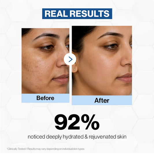 Exo-Restore Overnight Cream