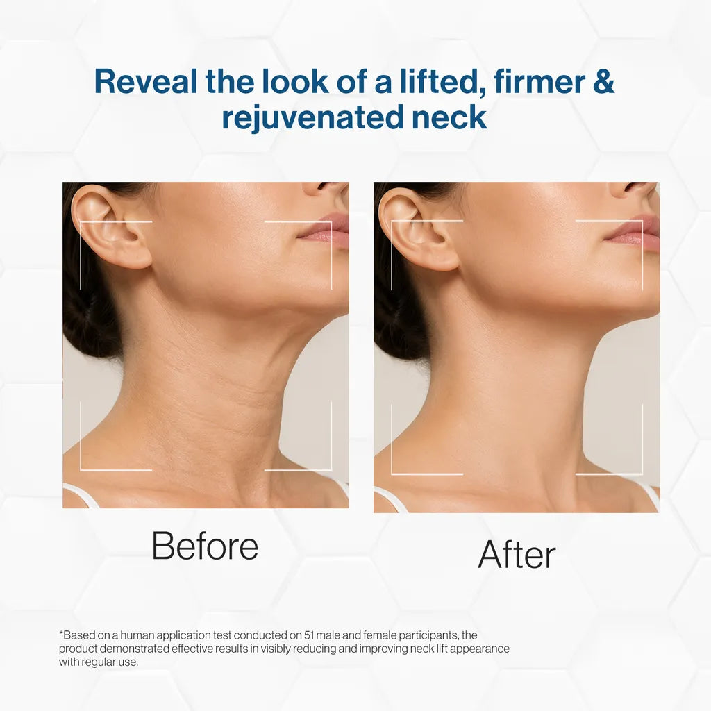 Neck Firming Complex