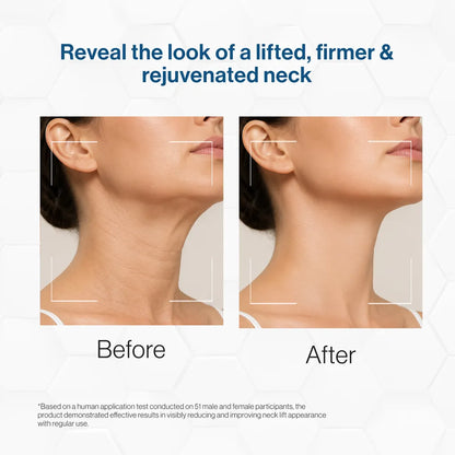 Neck Firming Complex
