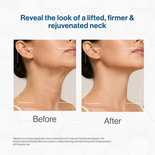 Neck Firming Complex