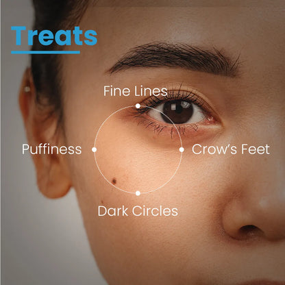 Eye Refining Matrix